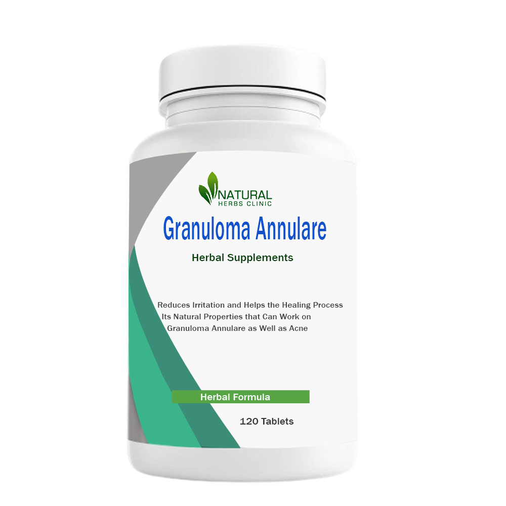 Best Treatment for Granuloma Annulare - Supplements for Granuloma Annulare
