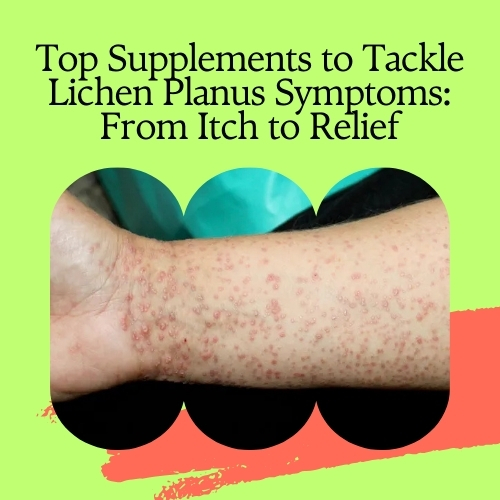 Top Supplements to Tackle Lichen Pl**** Symptoms: From Itch to Relief - Natural Health News