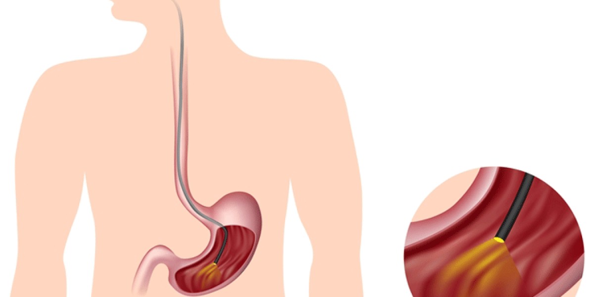 Gastroscopy singapore