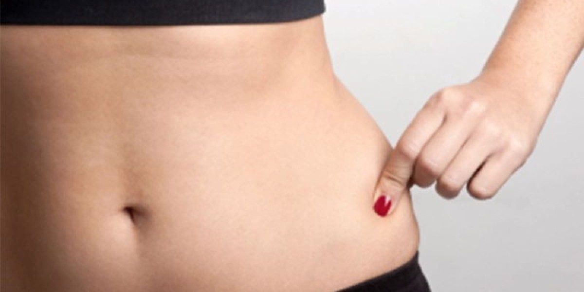 Effective Fat Reduction Treatment in Delhi at Akarabyaayna – Your Path to a Healthier You