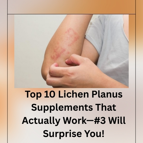 Top 10 Lichen Pl**** Supplements That Actually Work—#3 Will Surprise You! - Natural Herbs Clinic Blog