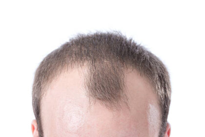When to Worry About Swelling: A Guide for Men's Health - Biz DirectoryHub