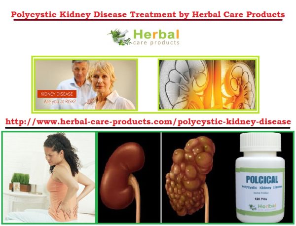 Treatment of Polycystic Kidney Disease Causes - Herbal Care Products - Blog