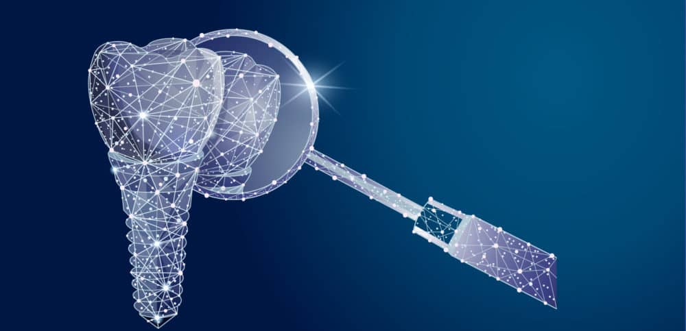 Restore Your Smile with Dental Crowns in Oakville